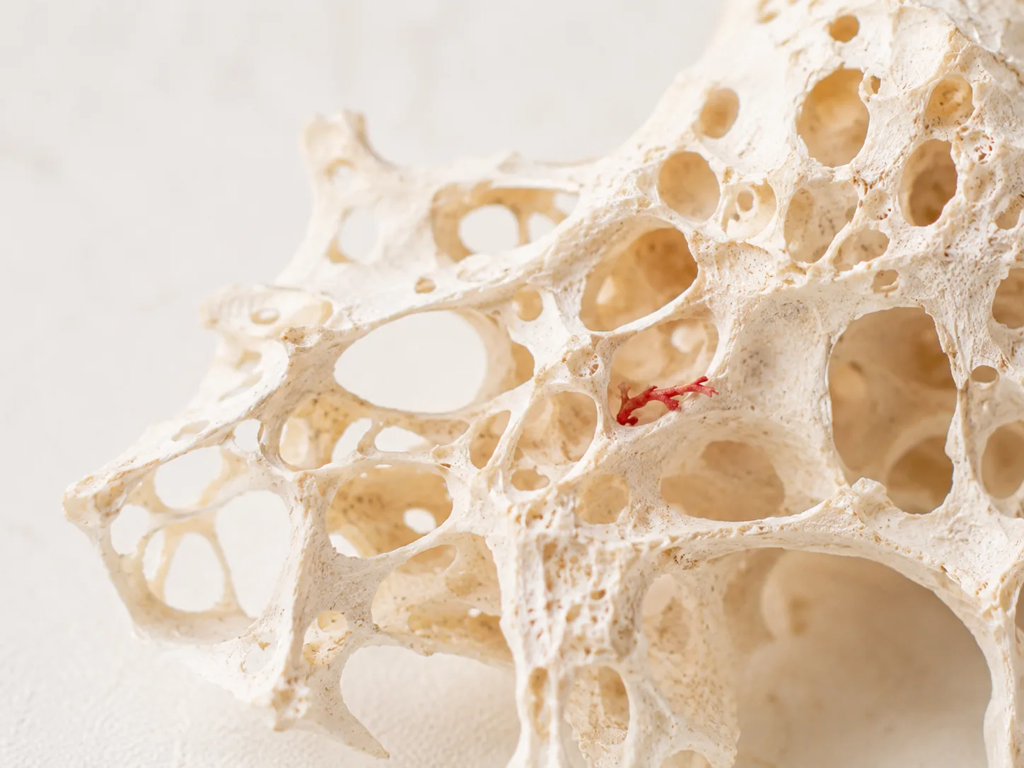 Bone Health Assessment - červený sloupec v grafu